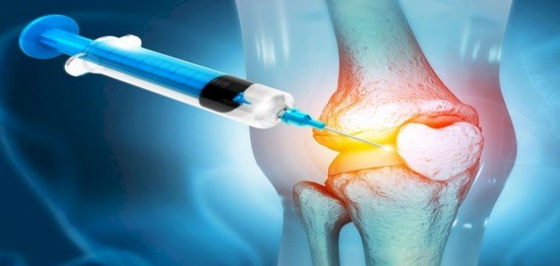 حقن البلازما لعلاج خشونة الركبة